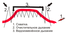 схема видоизменённого дыхания